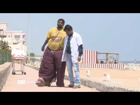 Аномалии тела на тлс все серии 2016 на тлс Аномалии тела на тлс все серии 2016 на тлс