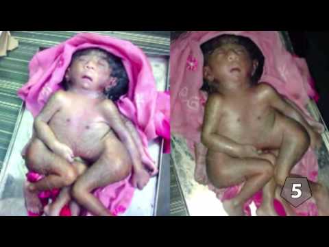 Аномалии тела на тлс все серии 2016 Аномалии тела на тлс все серии 2016